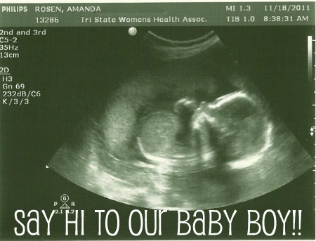 ultrasound pic